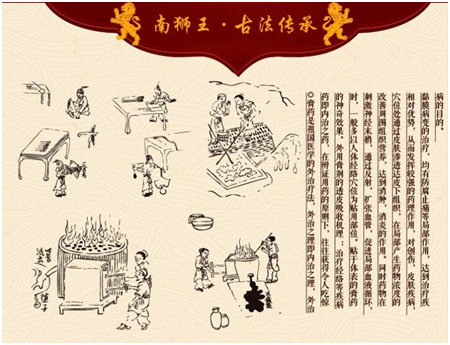 肩周炎久治不愈惹人煩 “南獅王”貼膏撥開謎團